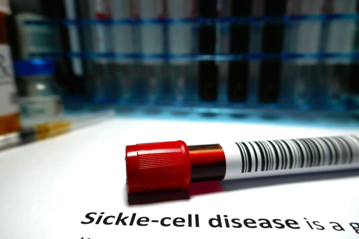 Sickle-cell disease - blood disorder abstract.
