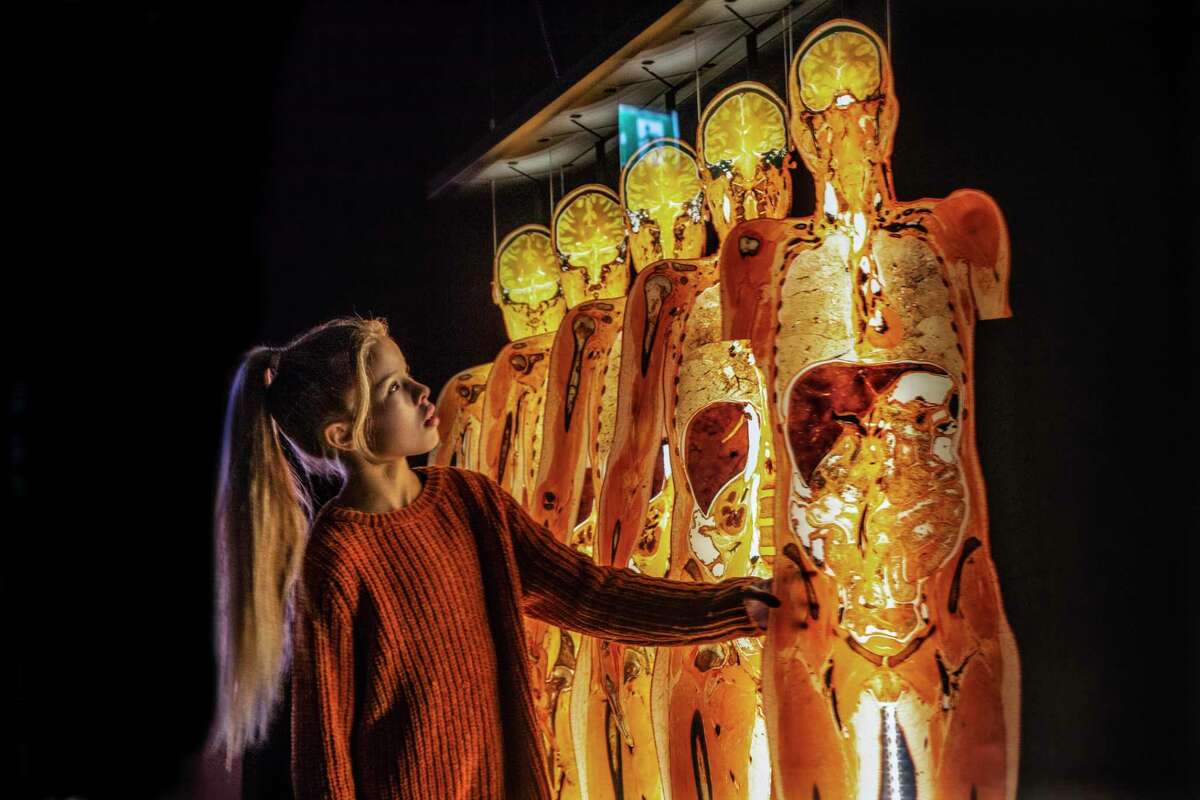 More Than 100 Bodies On Display As Body Worlds Returns To HMNS