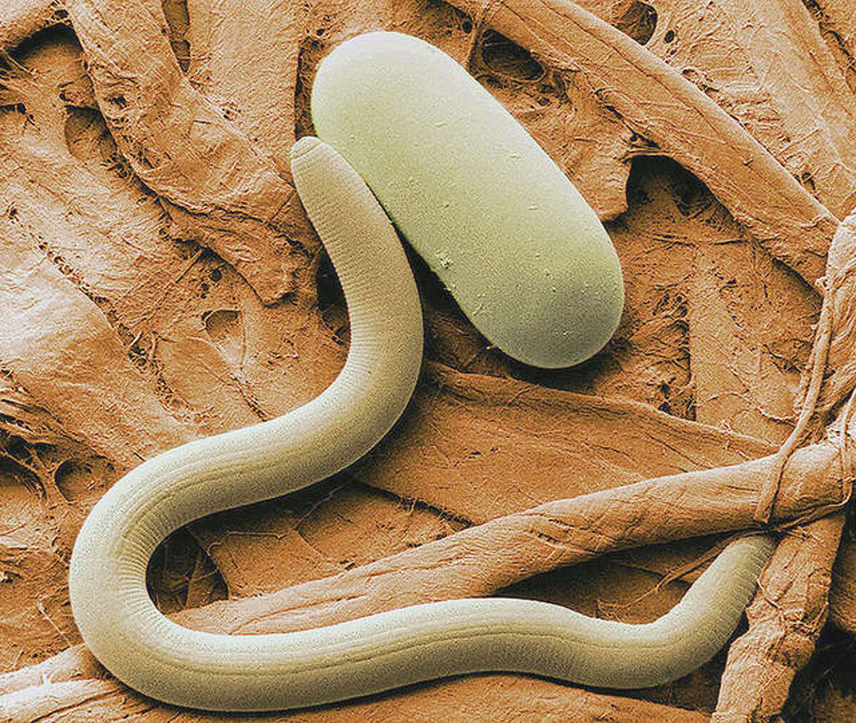 The soybean cyst nematode is a major pathogen of soybeans. A juvenile nematode is pictured here with an egg.