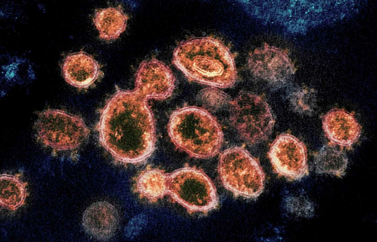 This 2020 electron microscope image provided by the National Institute of Allergy and Infectious Diseases - Rocky Mountain Laboratories shows SARS-CoV-2 virus particles which causes COVID-19, isolated from a patient in the U.S., emerging from the surface of cells cultured in a lab. New Canaan First Seletman Kevin Moynihan has given an update about the new virus, its cases in the town, other information about it, and the Halloween holiday for the town, to its residents, from Friday, October 30, 2020. (NIAID-RML via AP)