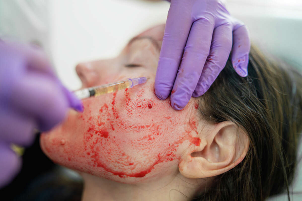 Plenty of Americans already go abroad for medical treatments including cosmetic surgeery.