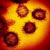 The Centers for Disease Control and Prevention have issued guidance toward shortening quarantine after COVID-19 exposure. (NIAID/TNS)