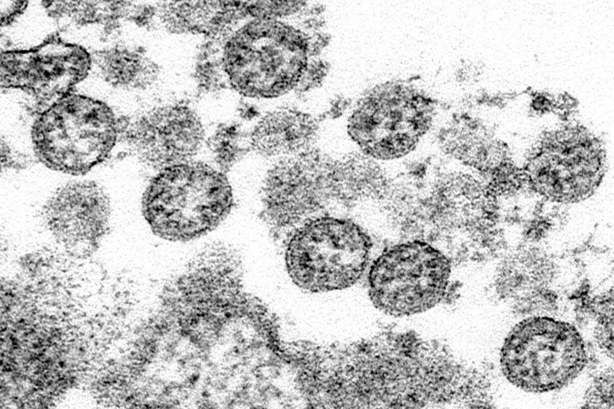 This 2020 electron microscope made available by the U.S. Centers for Disease Control and Prevention image shows the spherical coronavirus particles from the first U.S. case of COVID-19. Resolve to prioritize public health We often have an understandable focus on individual liberty in the United States. But that should not conflict with our ability to work for the greater, societal good. Going into the New Year, we should resolve to use medical testing to track the spread of disease and reduce transmission, not only as a means of individual diagnosis and treatment. Prioritizing public health also means the obvious: Wear masks, get inoculated. Understand that we are not islands, that we do not live in bubbles, that we are interconnected beings. It also means that we should resolve to focus our efforts on at-risk populations, particularly the elderly, those in economically difficult situations and people who have been marginalized due solely to the color of their skin.