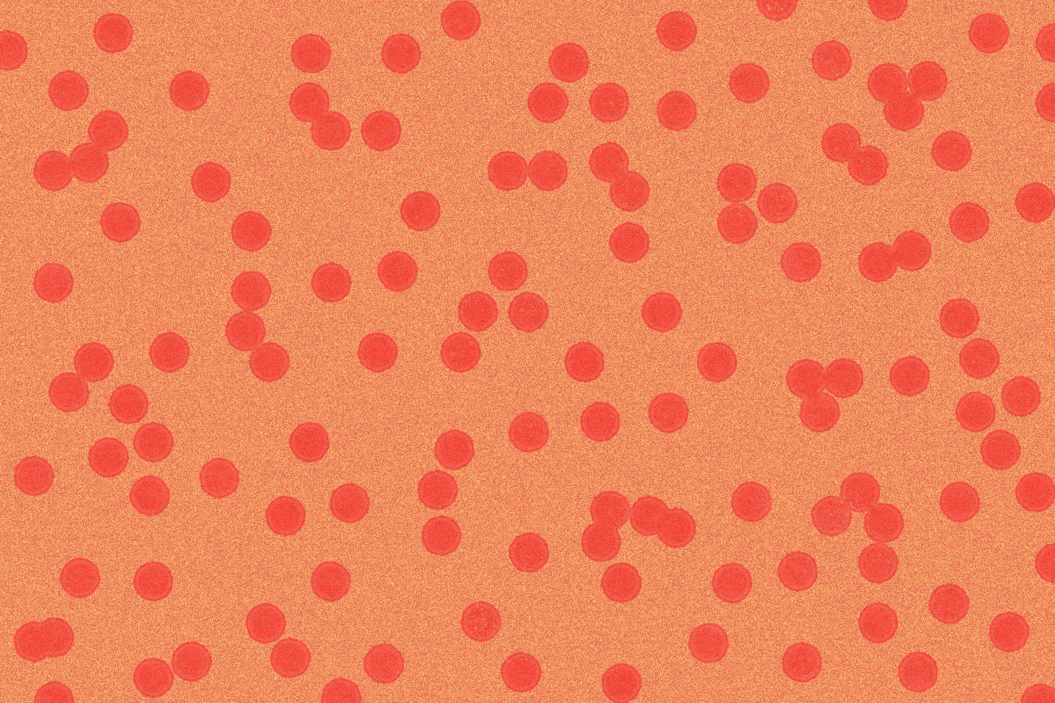 Why Is Herpes Stigma Still a Thing? - Vimarsana News