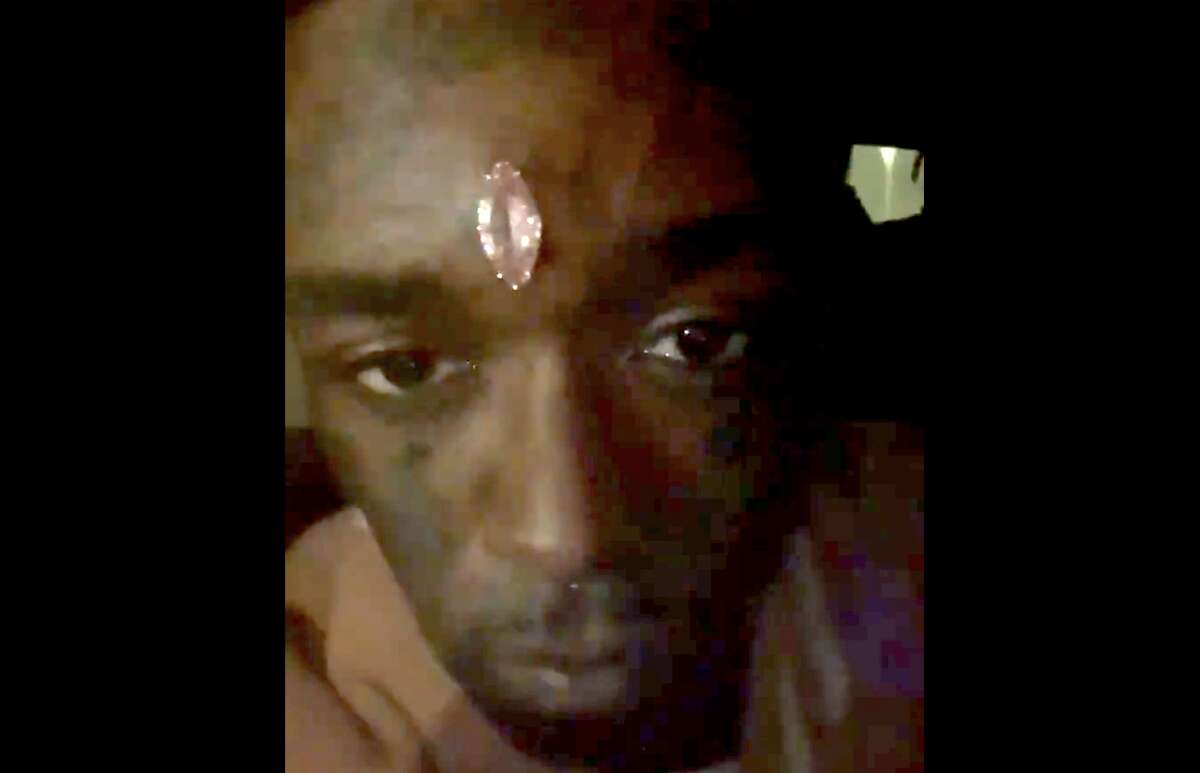 Rapper Lil Uzi receives multi-million dollar diamond implanted into his forehead.