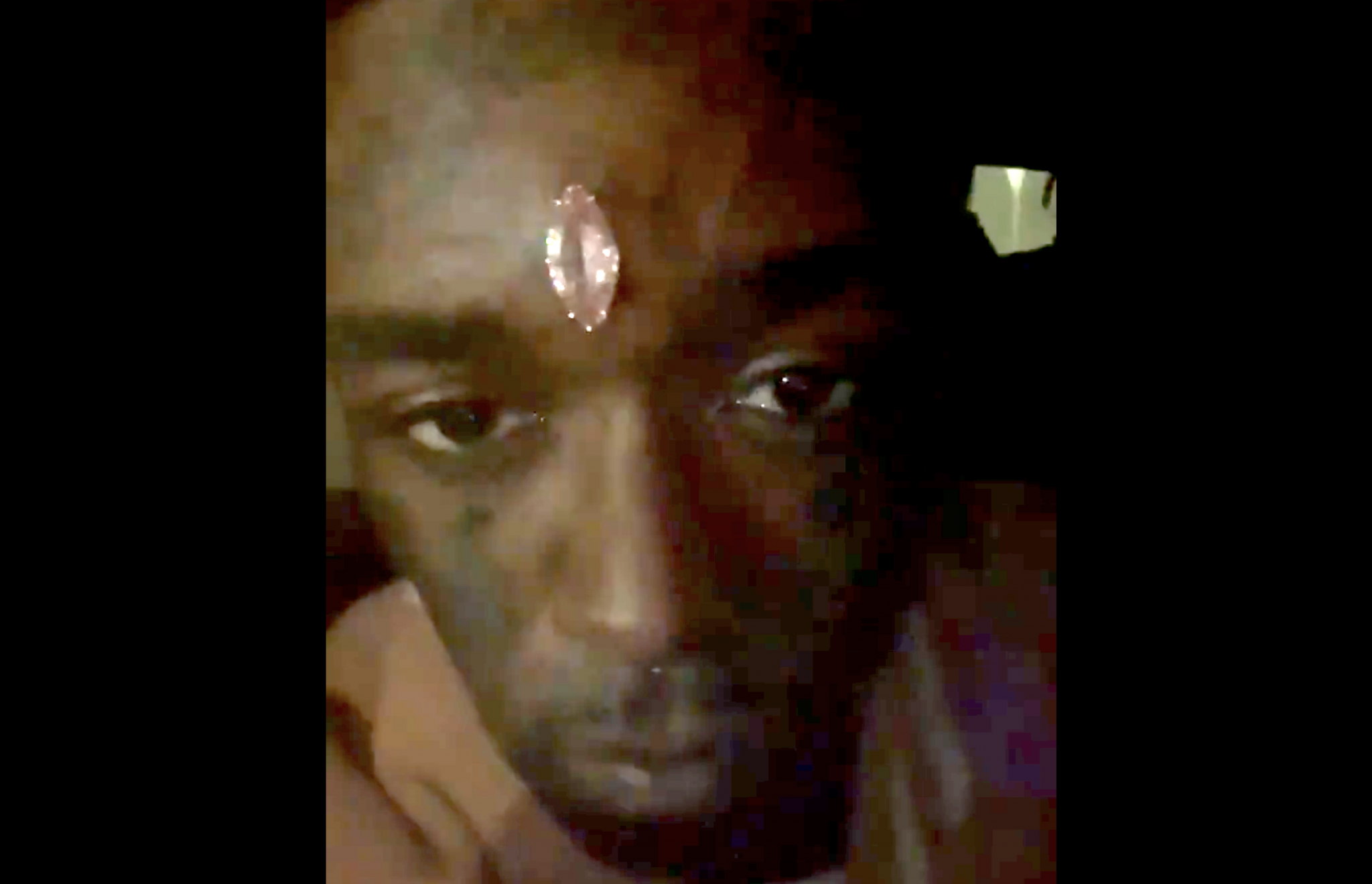 Lil Uzi bites Sauce Walka for expensive diamond face implants
