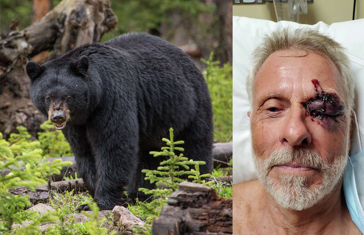 Left: A black bear (but not the one that attacked Ken DeCamp). Right: Ken DeCamp in the hospital shortly after the black bear attack on the East Fork Lakes Trail in the Trinity Alps.