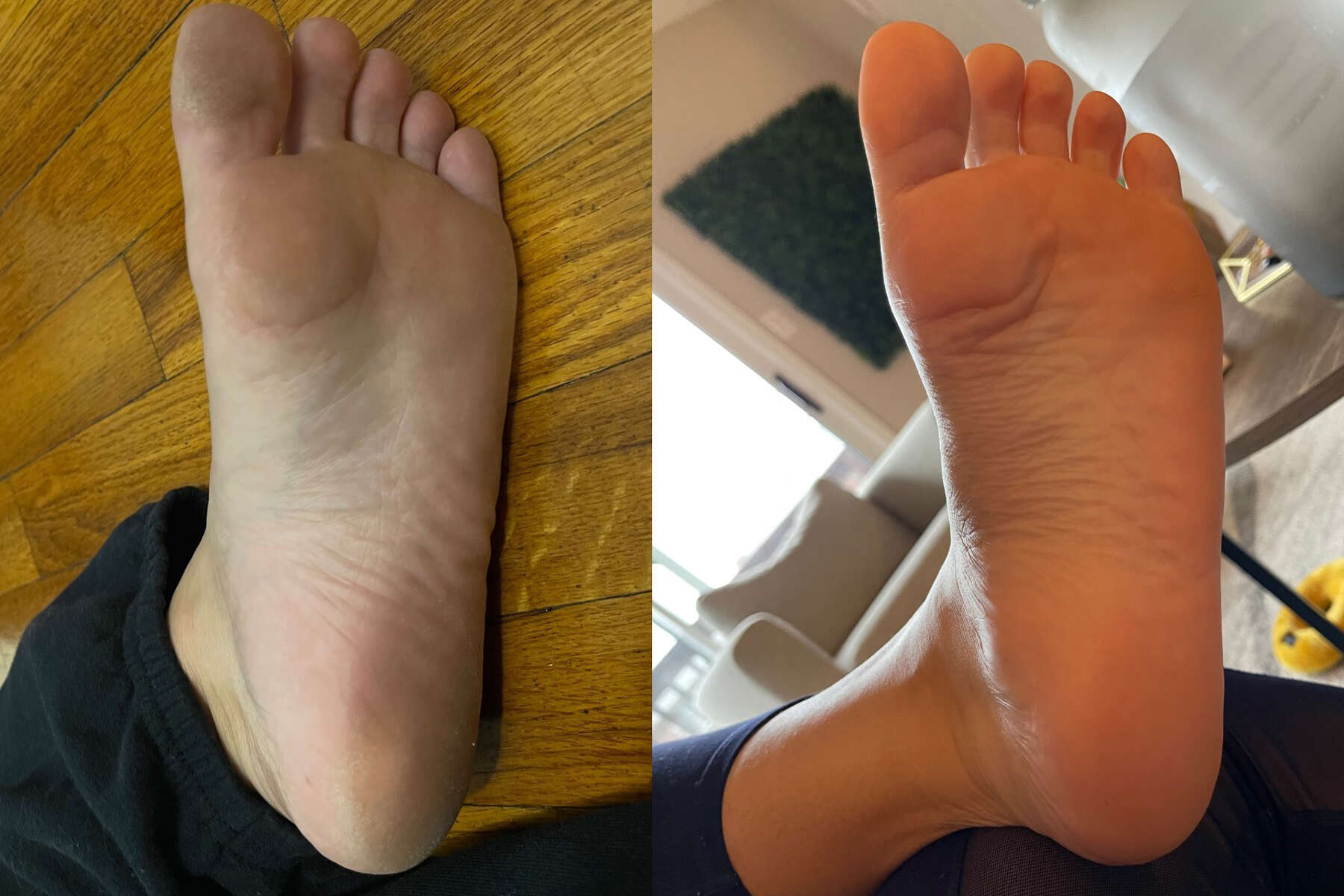 I Tried This 6 Foot Peel And Now I Have The Feet Of A Baby