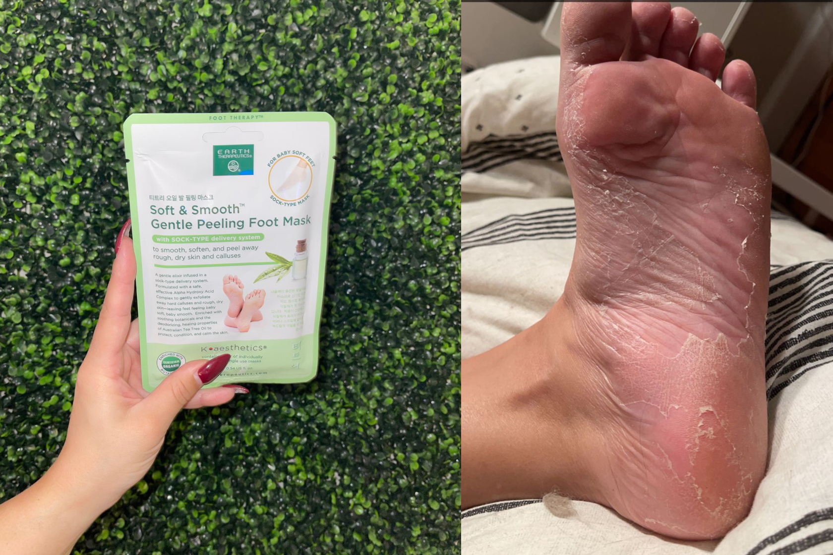 I Tried This 6 Foot Peel And Now I Have The Feet Of A Baby