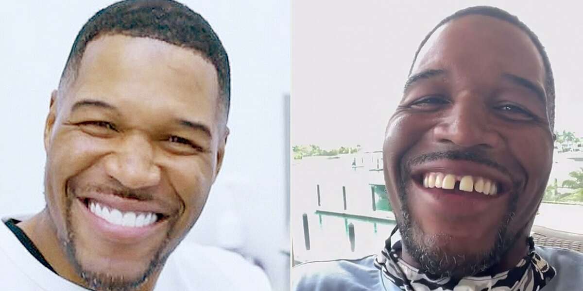 Michael Strahan reveals that closing his teeth gap was just a prank.