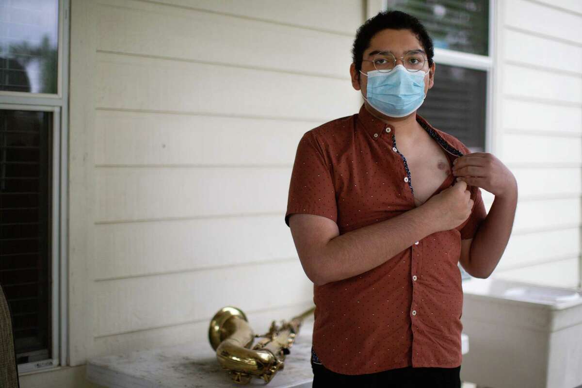 Jose Chavez,17, from the Rio Grande Valley shows the scar on his chest from being connected to a Extracorporeal Membrane Oxygenation (ECMO) machine, Monday, April 19, 2021, in Houston. Chavez received a double lung transplant in January 2021 after months of being on a ventilator. The longterm effects of COVID ravaged his lungs months after the virus left his system.