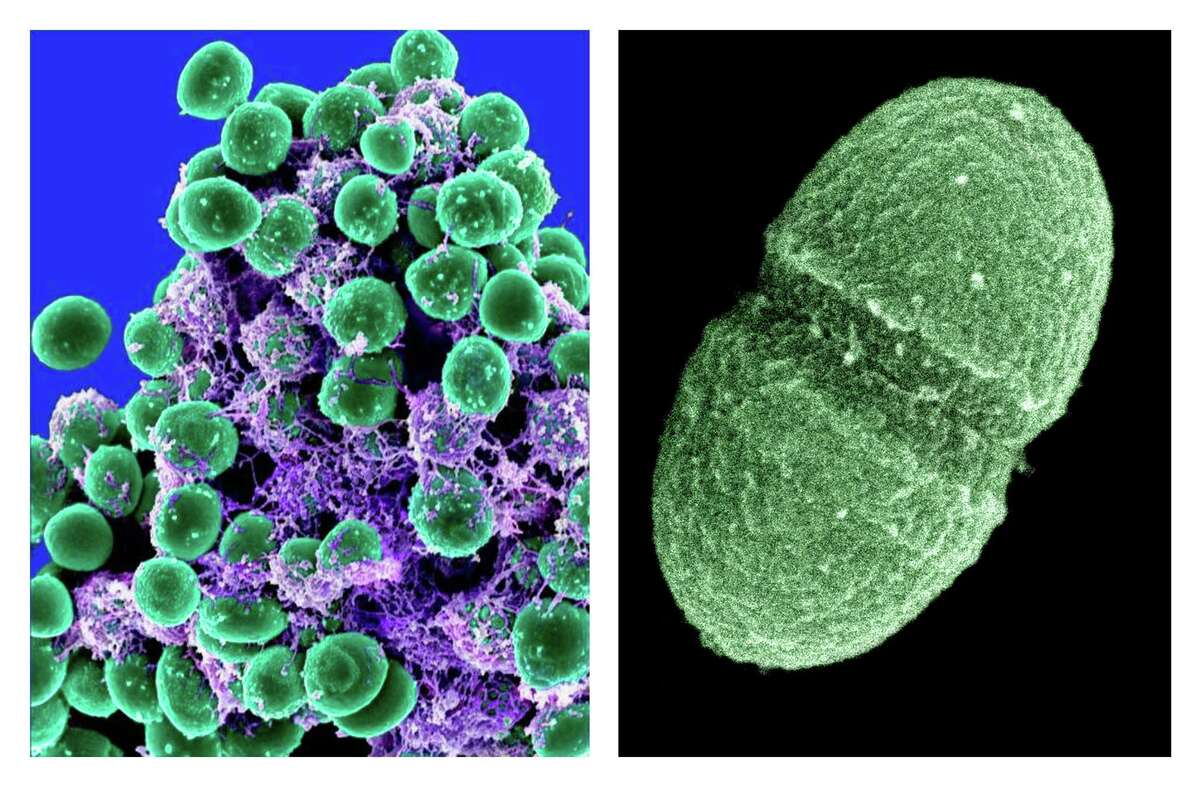At left, undated handout image provided by the National Institute of Allergy and Infectious Diseases (NIAID) shows a clump of Staphylococcus epidermidis bacteria (green) in the extracellular matrix, which connects cells and tissue, taken with a scanning electron microscope, showing. At right, undated handout image provided by the Agriculture Department showing the bacterium, Enterococcus faecalis, which lives in the human gut, is just one type of microbe that will be studied as part of NIH's Human Microbiome Project. They live on your skin, up your nose, in your gut _ enough bacteria, fungi and other microbes that collected together could weigh, amazingly, a few pounds. Now scientists have mapped just which critters normally live in or on us and where, calculating that healthy people can share their bodies with more than 10,000 species of microbes. (AP Photo/NIAID, Agriculture Department)