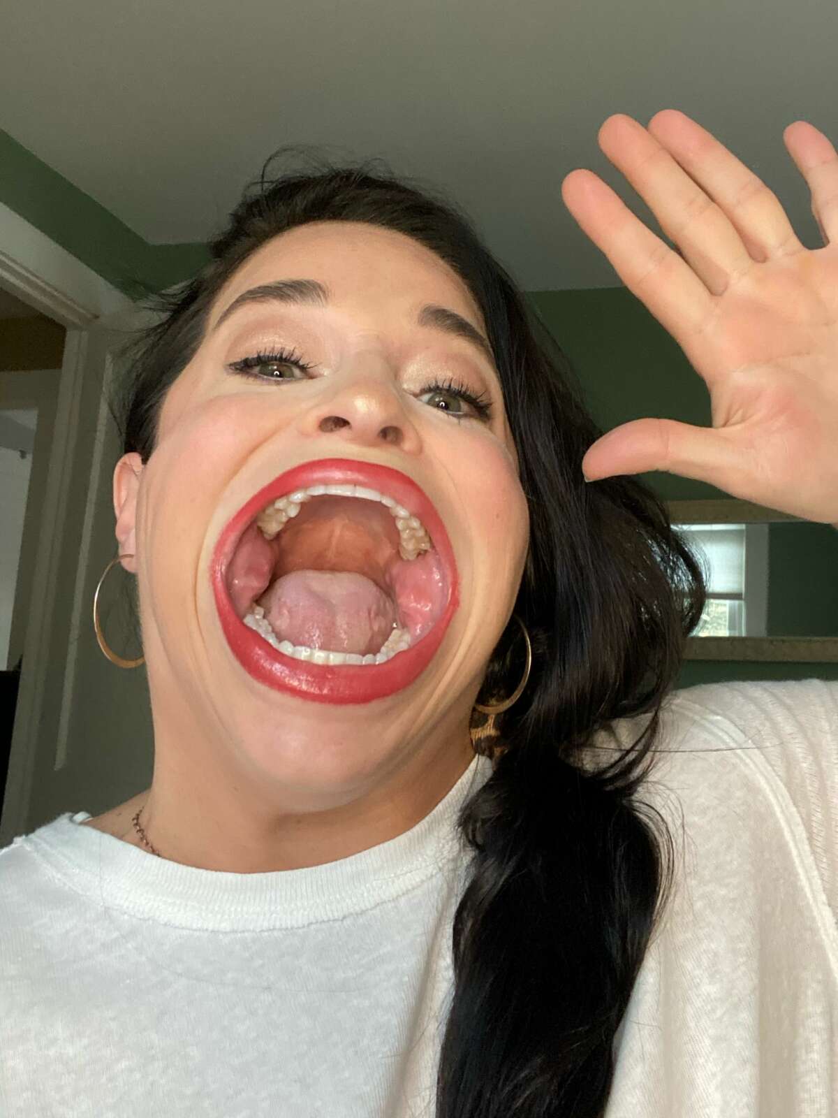 Stamford Woman Sets Guinness World Record For Largest Mouth Gape