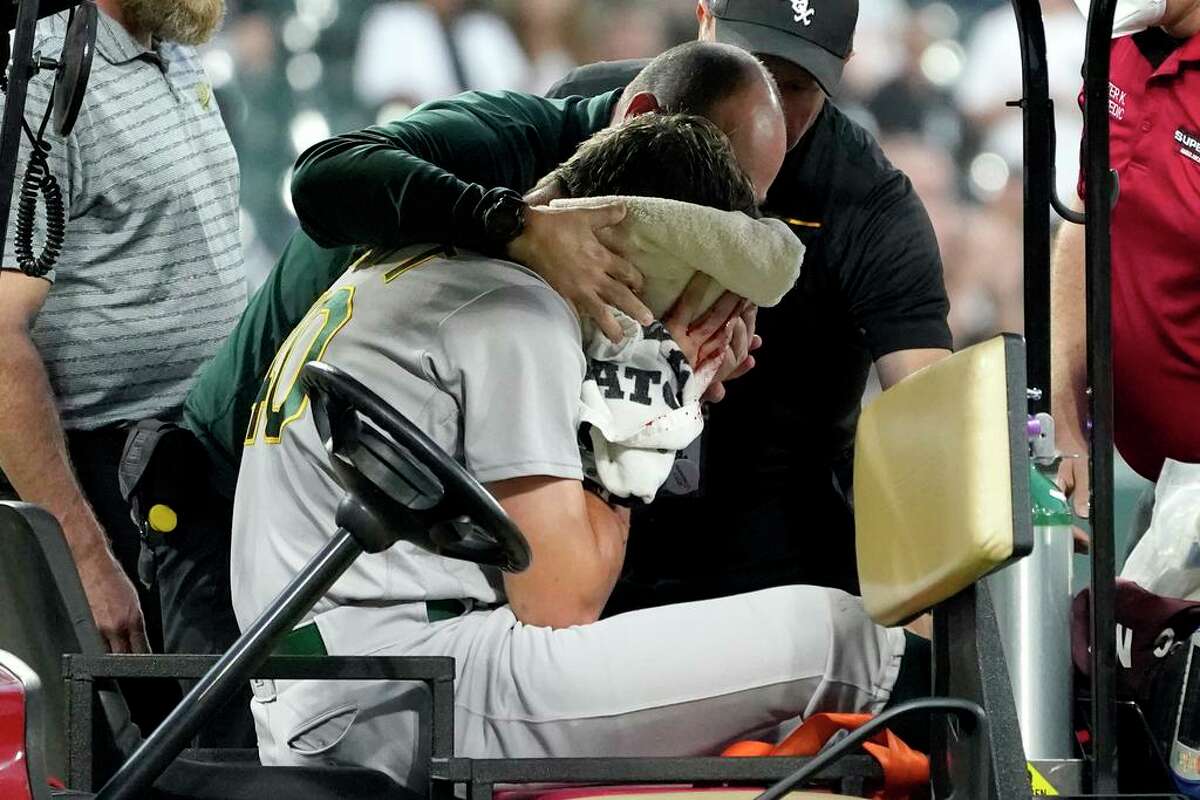 Oakland Athletics starting pitcher Chris Bassitt is attended to as he leaves the filed after getting hit in the head by a ball hit by Chicago White Sox's Brian Goodwin during the second inning of a baseball game Tuesday, Aug. 17, 2021, in Chicago. (AP Photo/Charles Rex Arbogast)