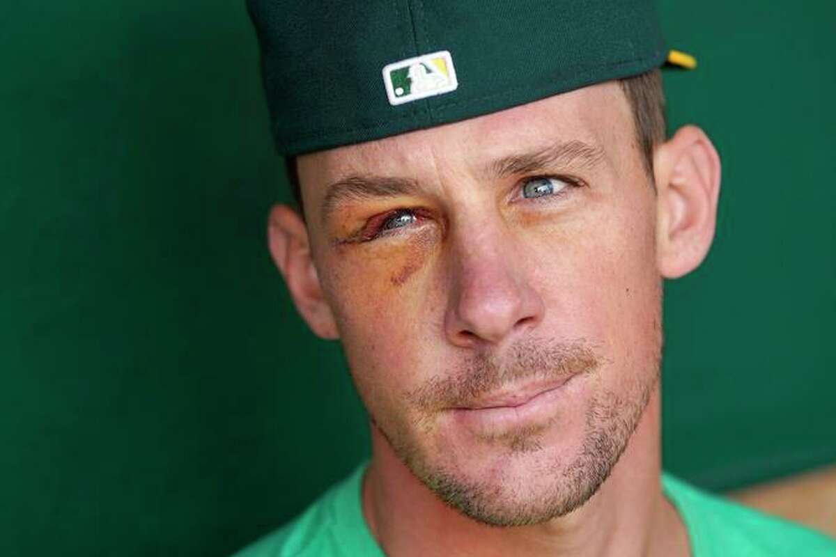 A's visited by injured Chris Bassitt, who is in 'good spirits