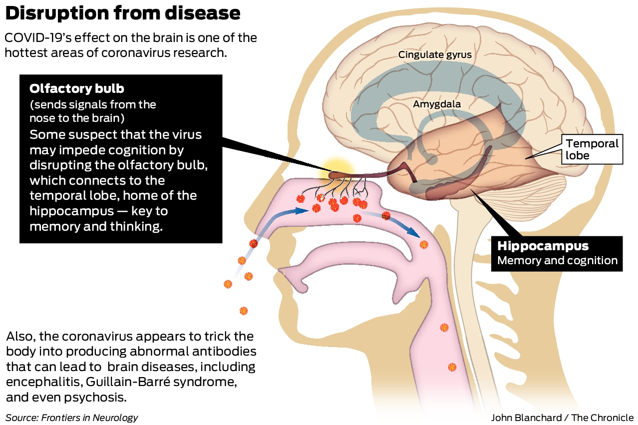 Here S What Bay Area Doctors Say About How Covid Affects The Brain
