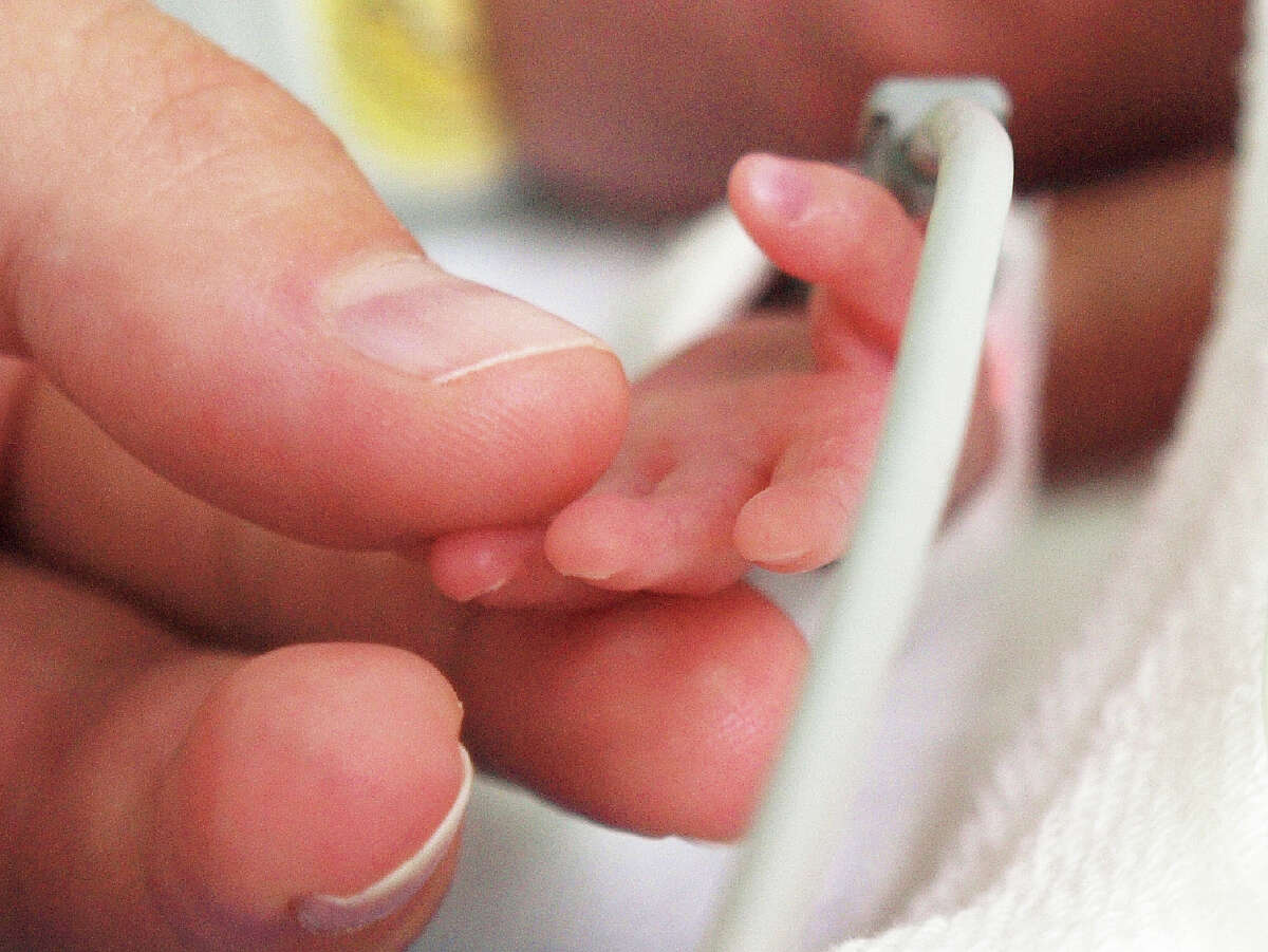 FILE — A mother is holding a tiny hand of her preterm baby that is in the NICU.