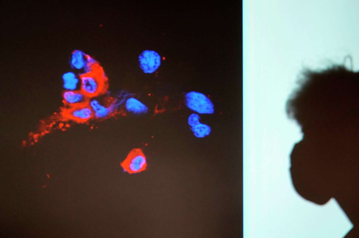 A projector image showing immunofluorescence staining of omicron infected Vero E6 cells is displayed on a screen.