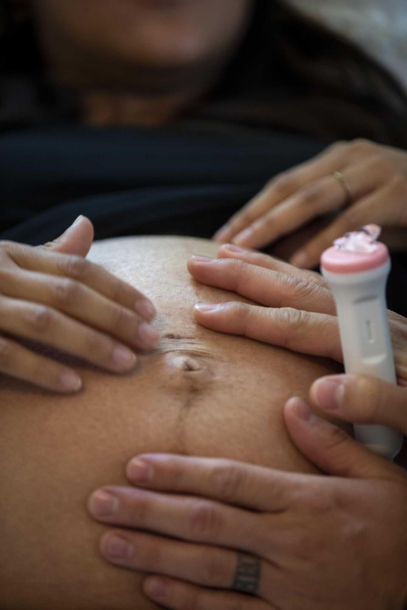 Commentary: Texas must do better for moms and babies - Vimarsana News