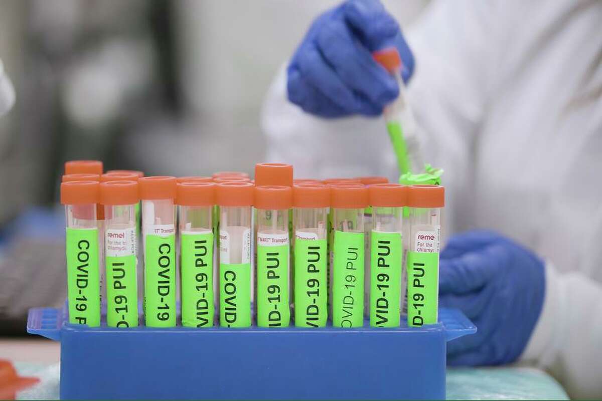 Coronavirus samples in the Stanford virology laboratory.