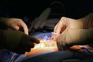 Surgery with fast healing among South Side hospital upgrades
