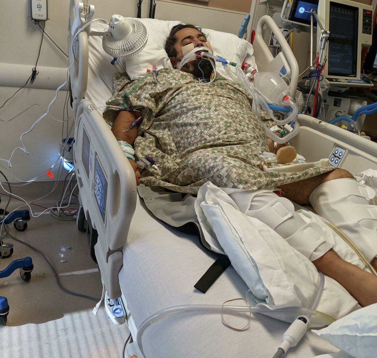 In September, Albert Bañuelos, diagnosed with the COVID-19 Delta variant, lies in a medically-induced coma, intubated and attached to a mechanical ventilator to help him breathe, as doctors and nurses cared for him at Methodist Hospital Northeast.