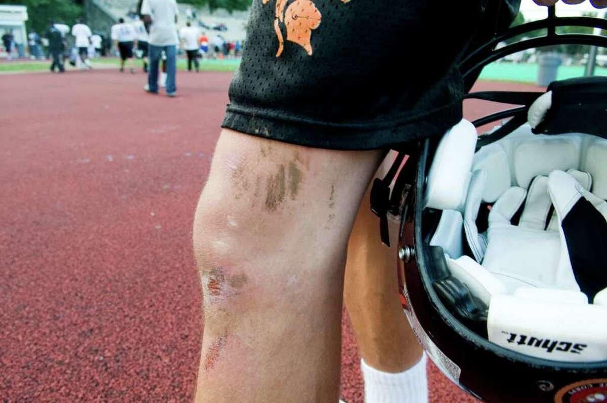 debo samuel turf burn