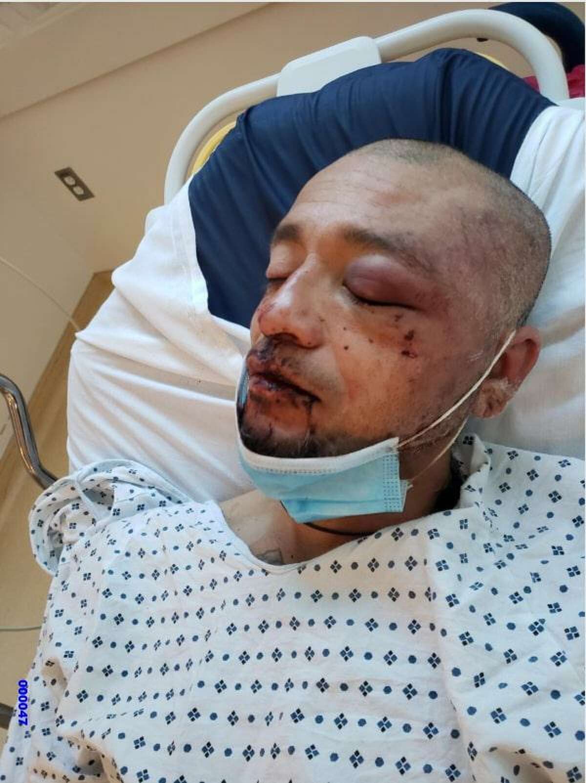 Sergio Lugo was injured in a February confrontation with three S.F. police officers.