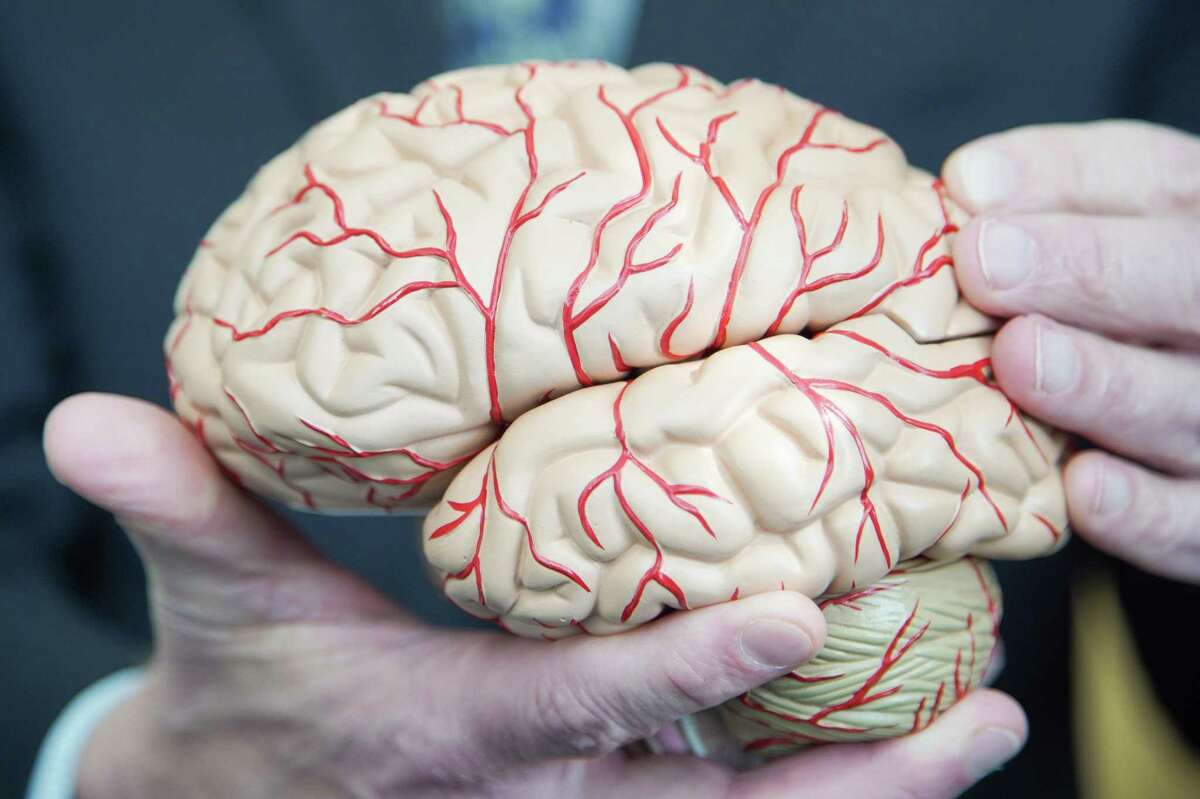 Dr. Paul E. Schulz holds a model brain at UTHealth Neurosciences Neurocognitive Disorders Center in Houston on Thursday, Jan. 13, 2022. Medicare issued a preliminary decision Tuesday to restrict access to the Alzheimer’s drug Aduhelm to patients who participate in approved clinical trials.