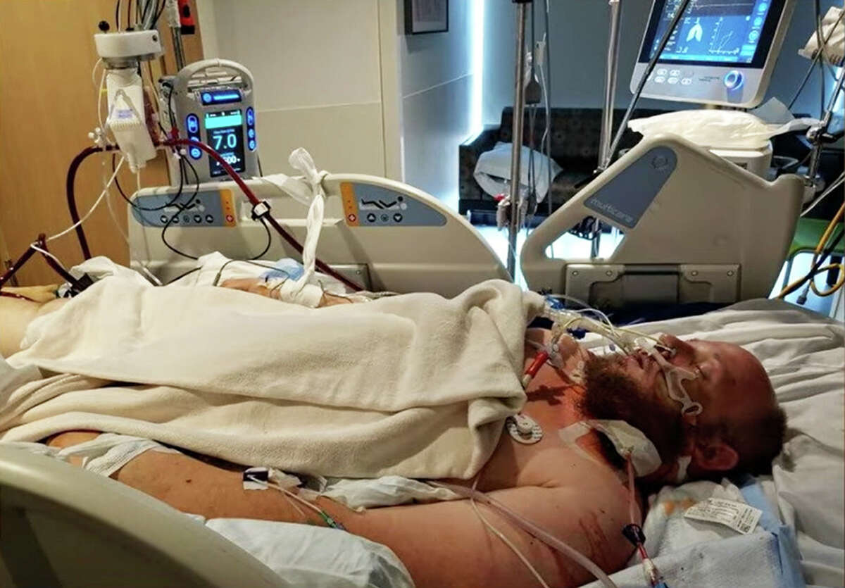 Former Maryville resident Bryan Glebavicius had a nearly three-month stay at SSM Health Saint Louis University Hospital due to life-threatening complications from COVID-19. Glebavicius, who was unvaccinated, Barnes-Jewish Hospital awaiting a lung transplant.