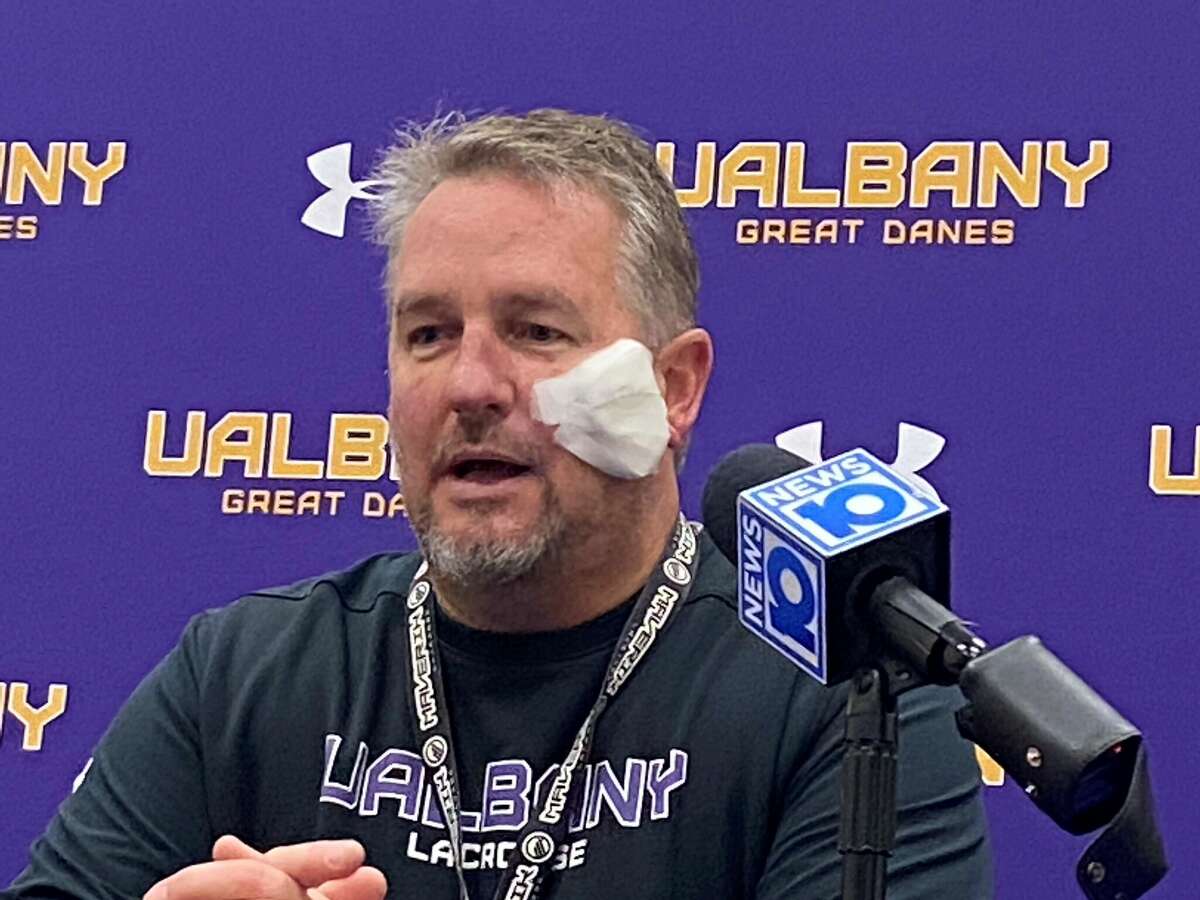 UAlbany men's lacrosse coach Scott Marr ran practice on Wednesday, just hours after having surgery to remove skin cancer. (Mark Singelais/Times Union)