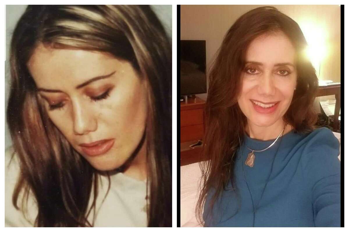 Claudia Cossio got her first nose job as a teenager. After five surgeries, Cossio felt she had botched her nose. She recently appeared on an episode of "Botched" to have a six surgery to fix the problems the other surgeries created.