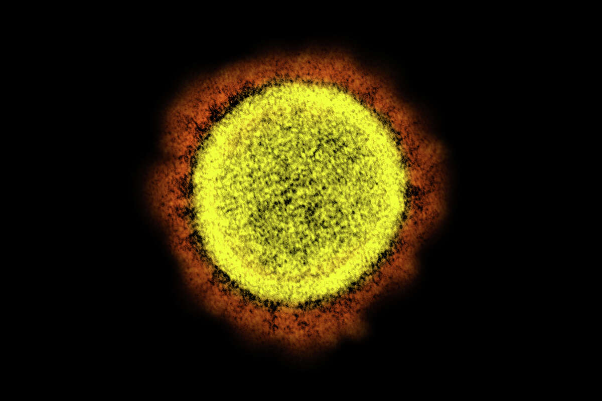 This 2020 electron microscope image made available by the National Institute of Allergy and Infectious Diseases shows a Novel Coronavirus SARS-CoV-2 particle isolated from a patient, in a laboratory in Fort Detrick, Md. The coronavirus mutant widely known as stealth omicron is now causing more than a third of new omicron cases around the world. But scientists still don't know how it could affect the future of the pandemic.