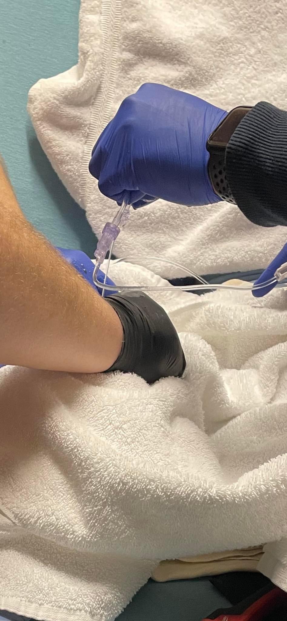 Derby first responders free child's finger stuck in doorknob - Vimarsana News