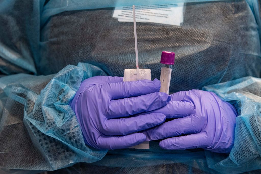 More infectious omicron subvariant expected to become dominant in U.S. - Vimarsana News