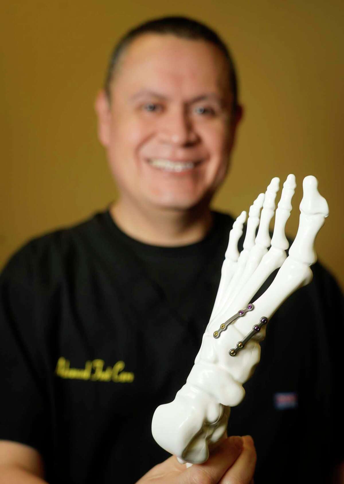 Dr. Fernando Fernandez, a podiatrist, holds a model of a foot with the two low-profile, anatomically-shaped titanium plates used in the Lapiplasty 3D bunion correction shown Friday, March 4, 2022, in The Woodlands.