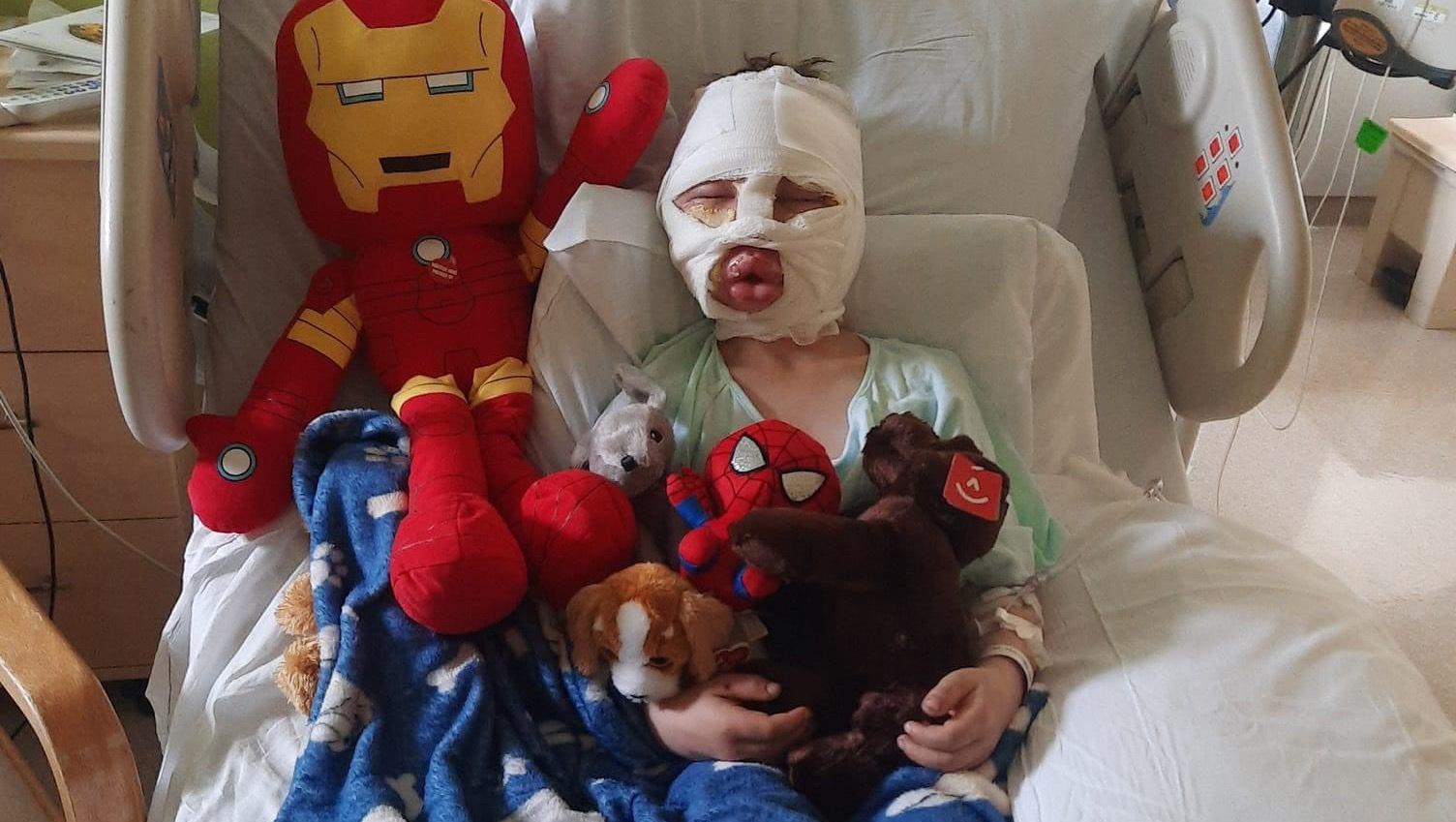 Bridgeport boy burned by gasoline leaves hospital - Vimarsana News