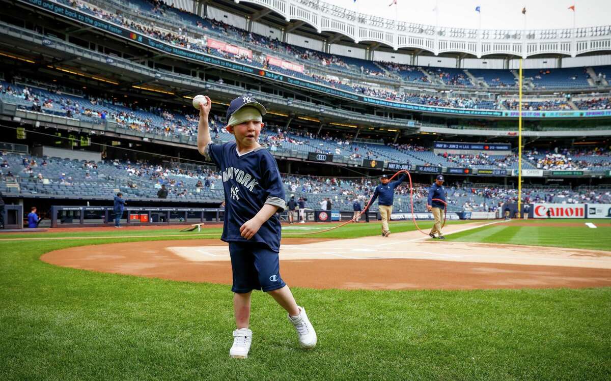 Yankees host Bridgeport boy burned by gasoline