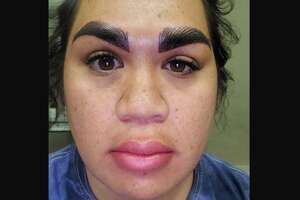 Texas woman speaks out after botched microblading experience