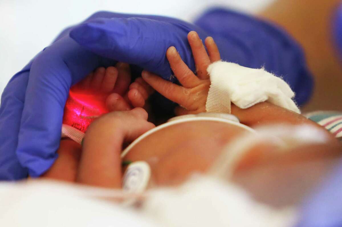 Rebekah Espinosa, a 12-day-old baby born prematurely pushes against a speech therapist’s hand during oral pharyngeal mother’s milk therapy at DHR Health Women’s Hospital in Edinburg on May 9, 2022.
