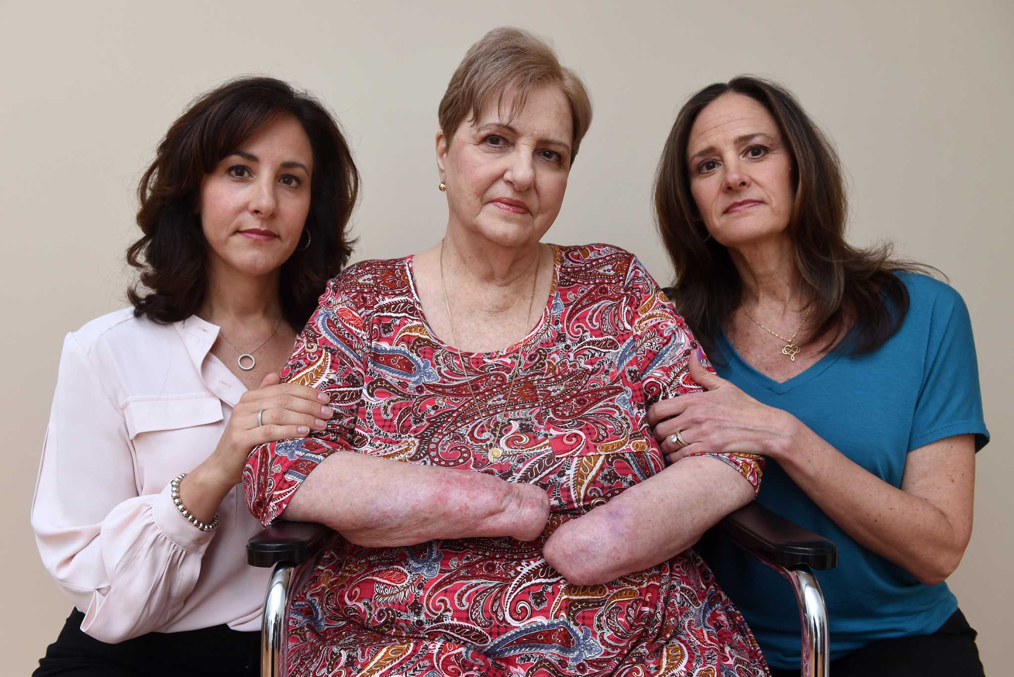 Woman sues Griffin Hospital after losing hands, foot from severe sepsis - Vimarsana News