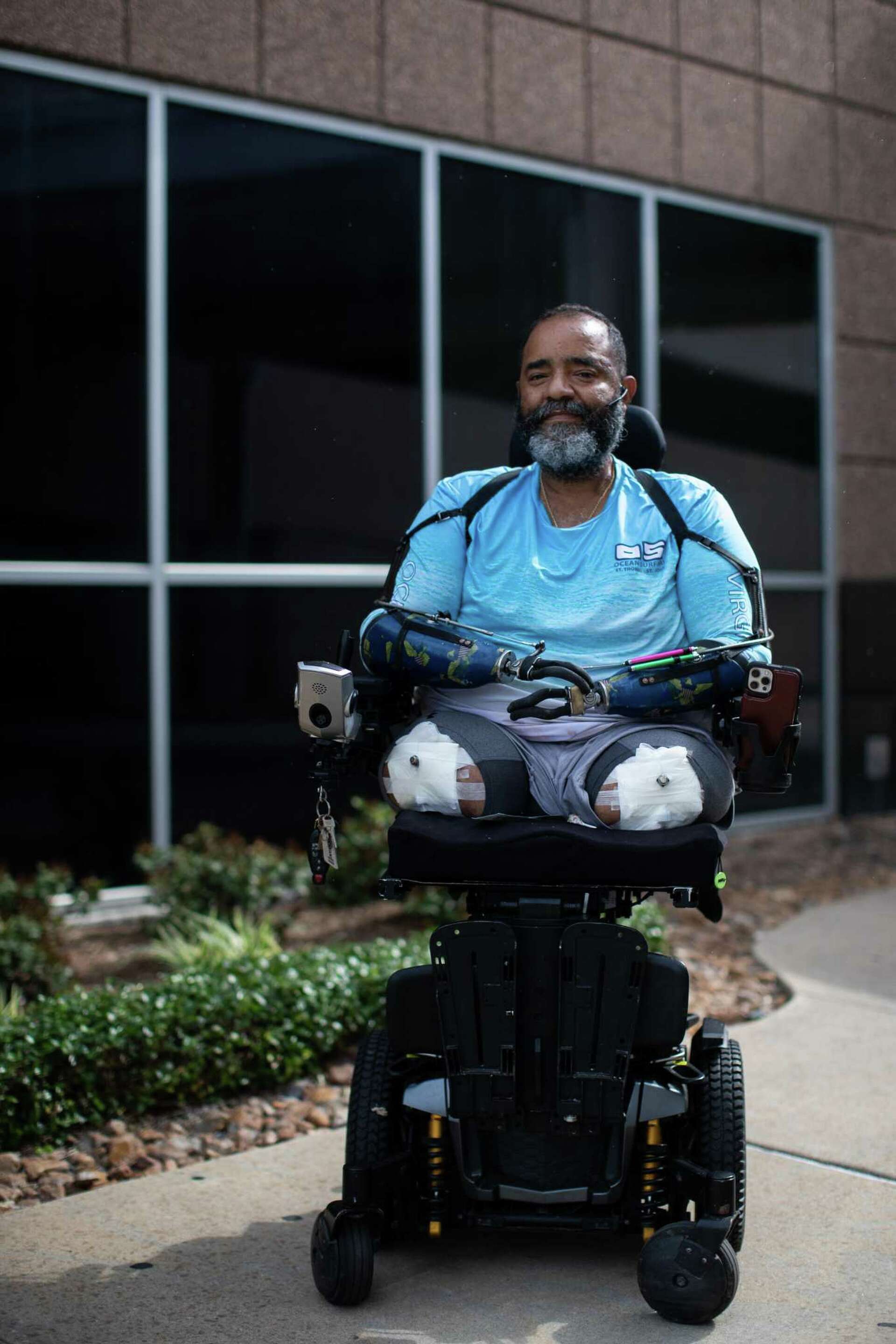 Rare procedure gives quadruple amputee a future with painfree prosthetics