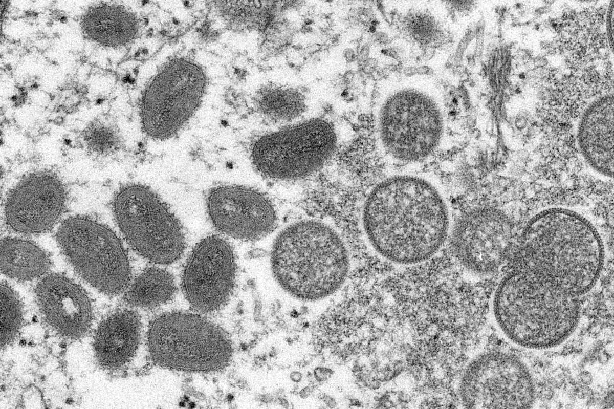 This 2003 electron microscope image made available by the Centers for Disease Control and Prevention shows mature, oval-shaped monkeypox virions (left) and spherical immature virions obtained from a sample of human skin associated with the 2003 prairie dog outbreak.