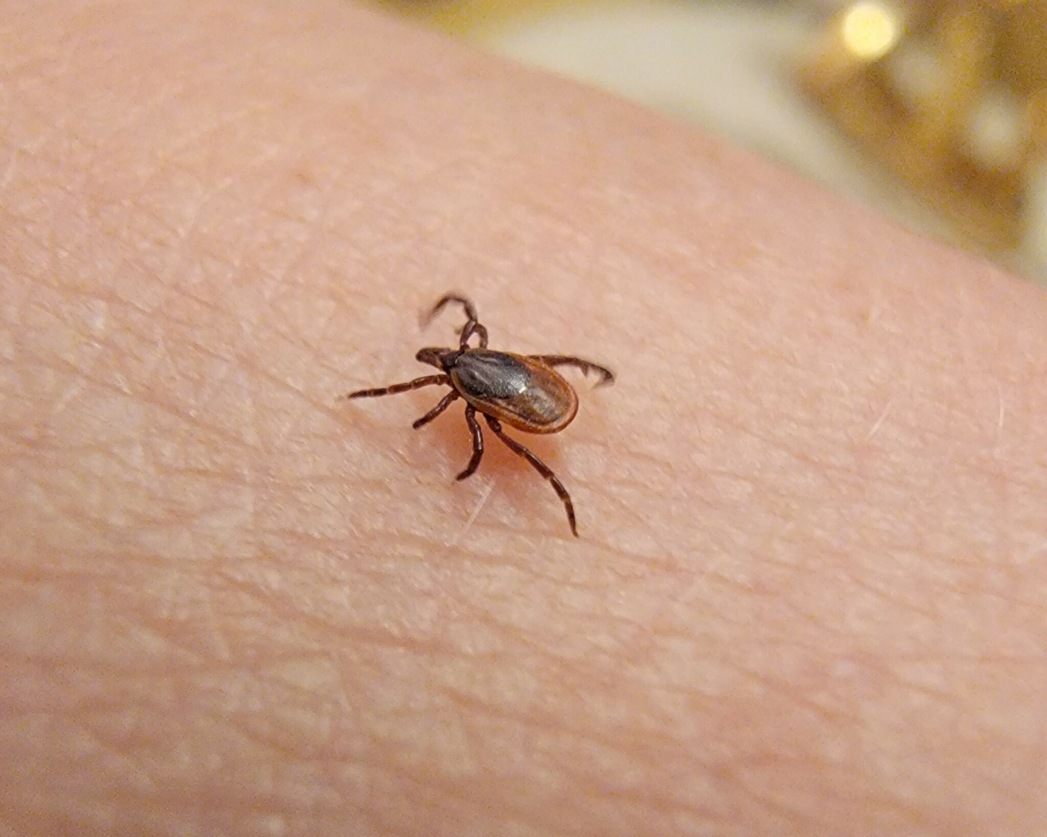 What to know to keep yourself safe from tick illnesses as Lyme cases double - Vimarsana News