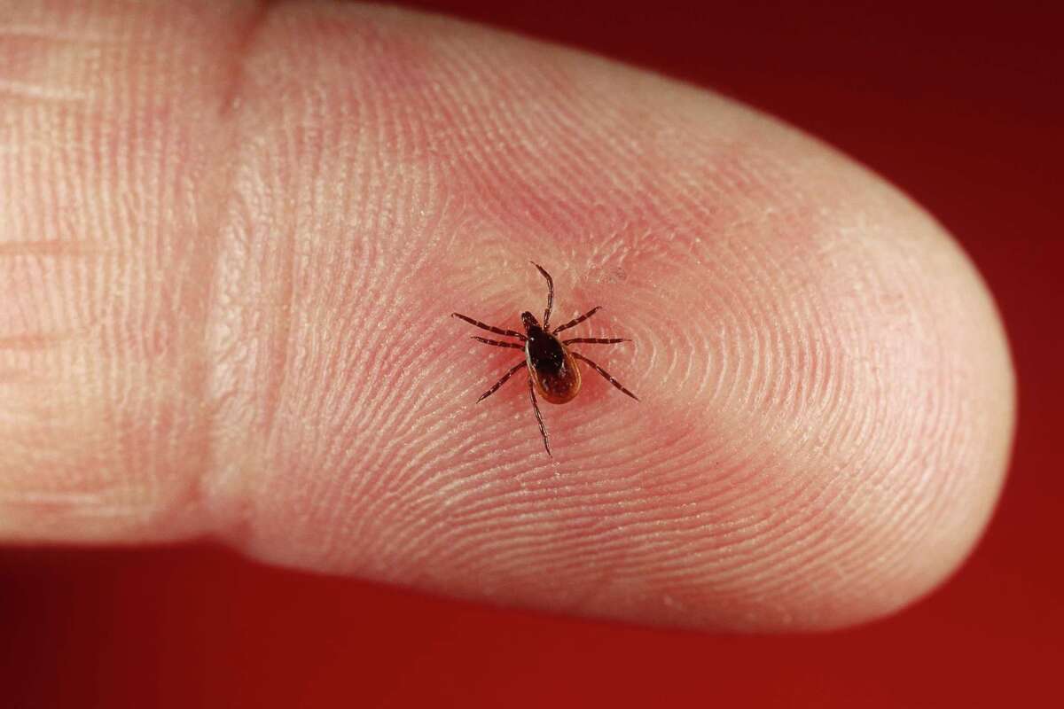 A female deer tick. The Powassan virus infection is usually spread through the bite of an infected black-legged or deer tick.