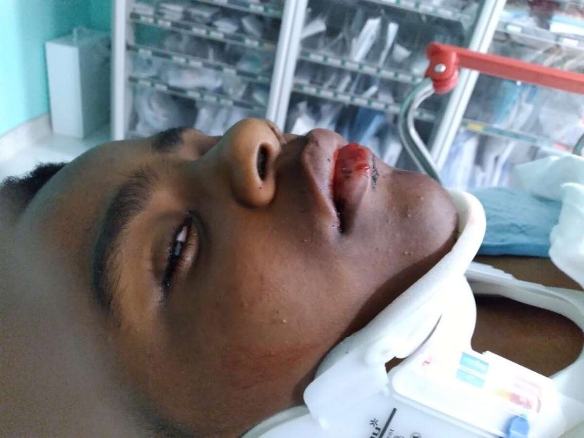 Kameron Duckworth, 13, pictured in the emergency room after he was struck by a hit-and-run driver in early May 2022 while walking home from school. Duckworth spent only four hours in the hospital before doctors discharged him.