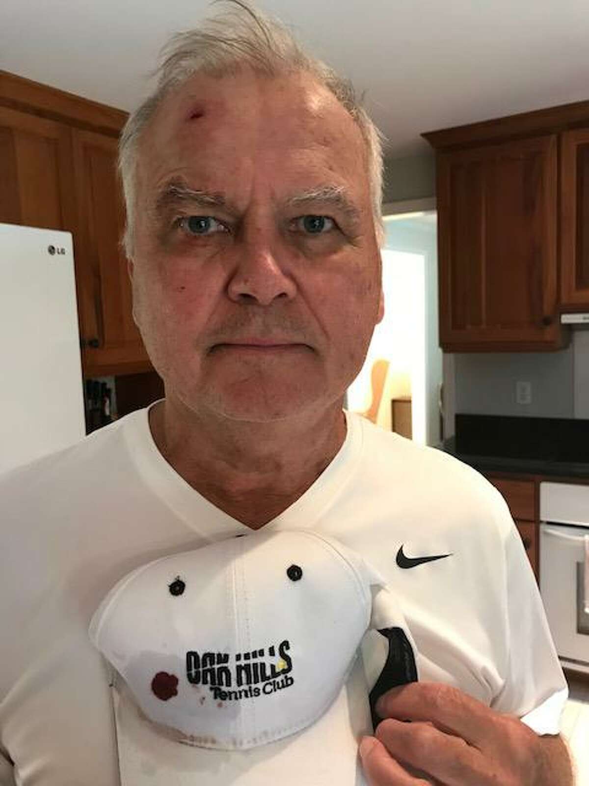 Peter Kryworuczko was struck in the head by a stray golf ball while playing tennis at Oak Hills Park. This photo was taken on the day he was injured in September 2021.
