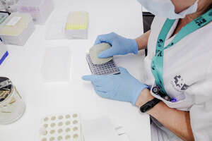 US monkeypox cases increase nearly nine-fold in three weeks