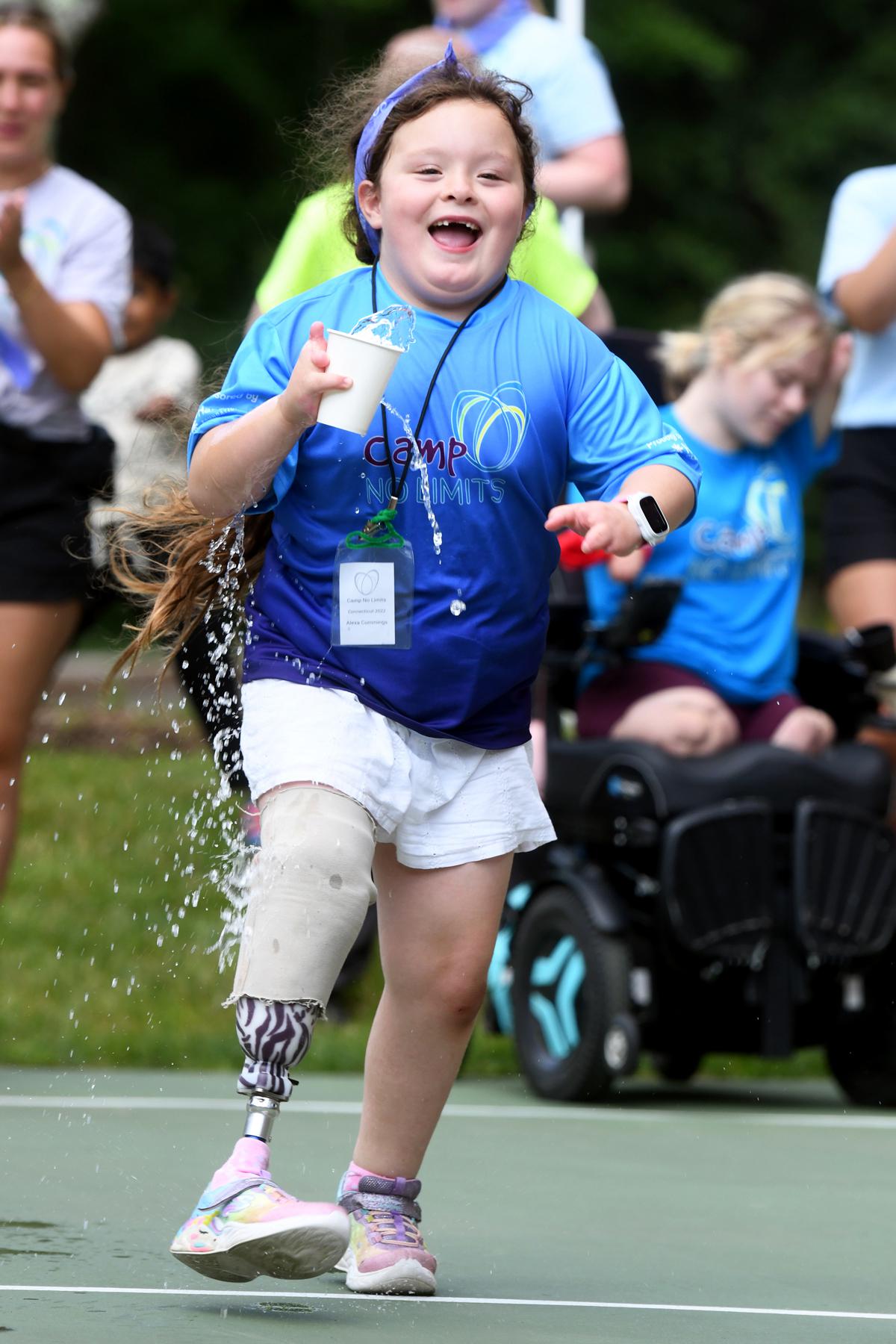 At Quinnipiacbased camp, there are ‘no limits’ for kids with limb loss