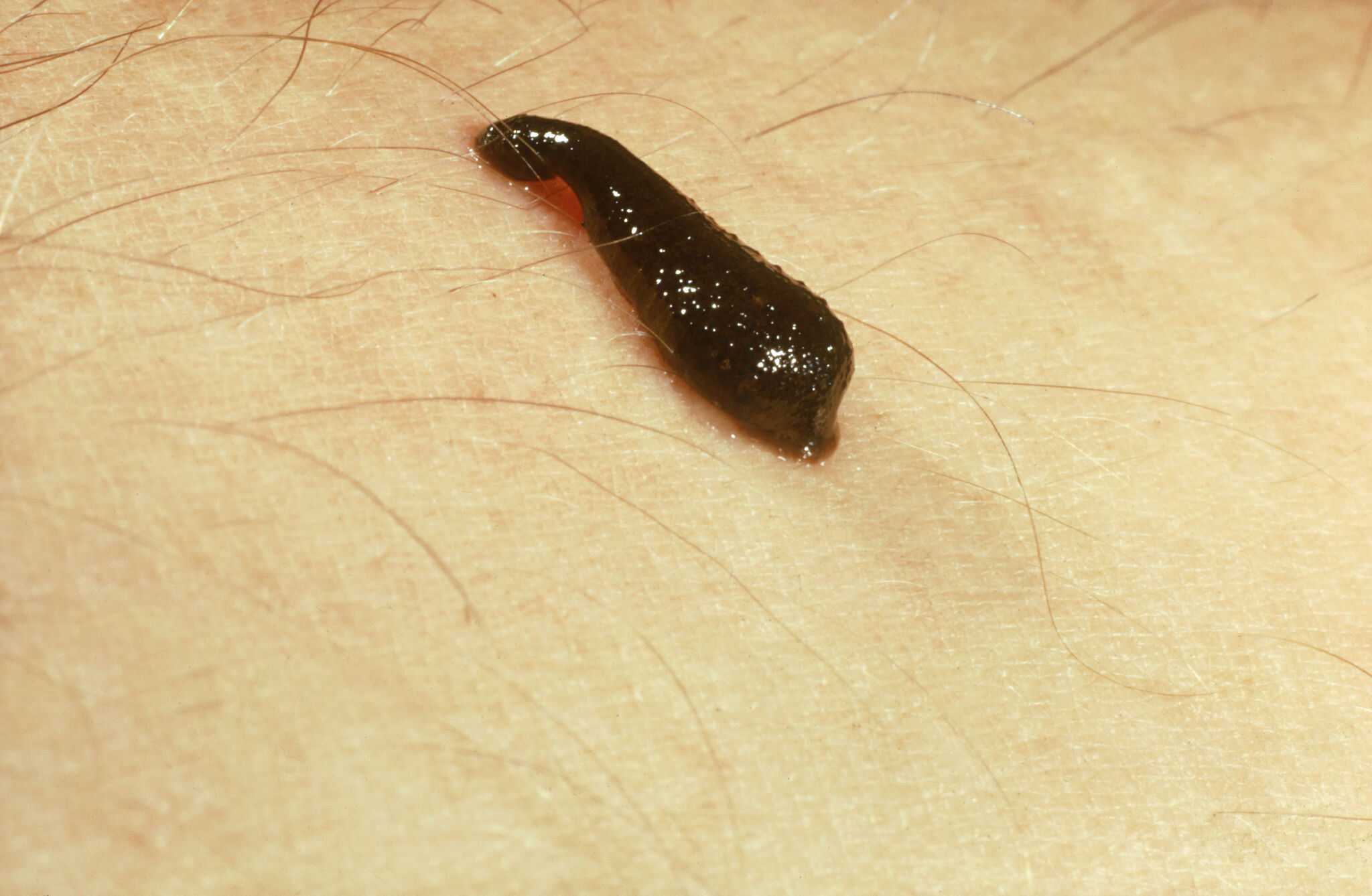 Are There Leeches In Texas?